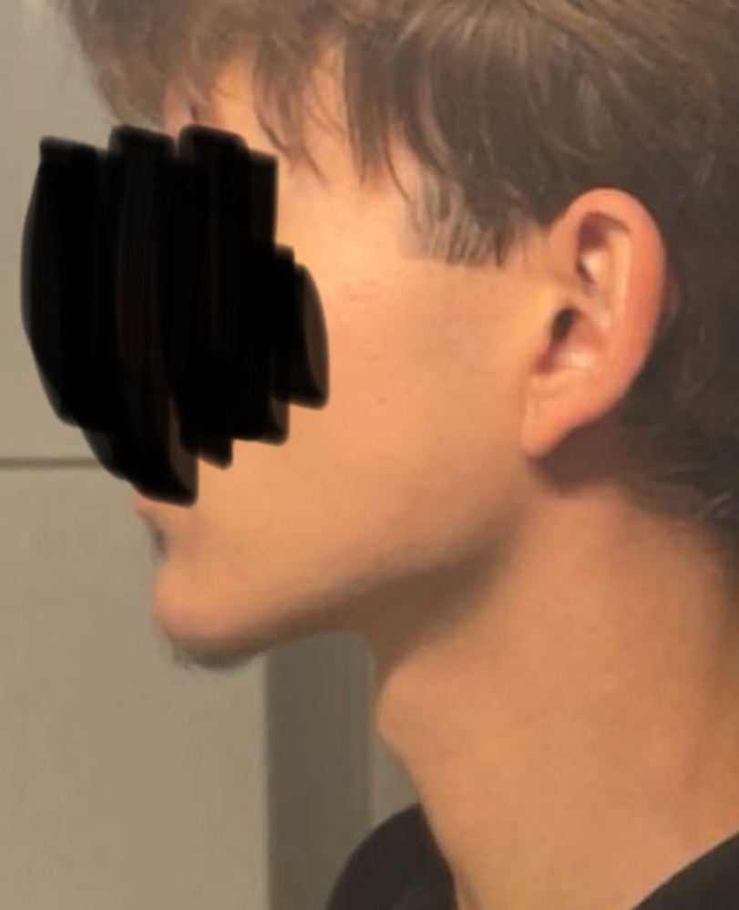 1000026393
