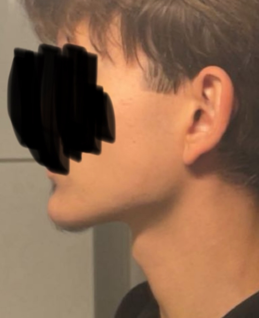 1000026434