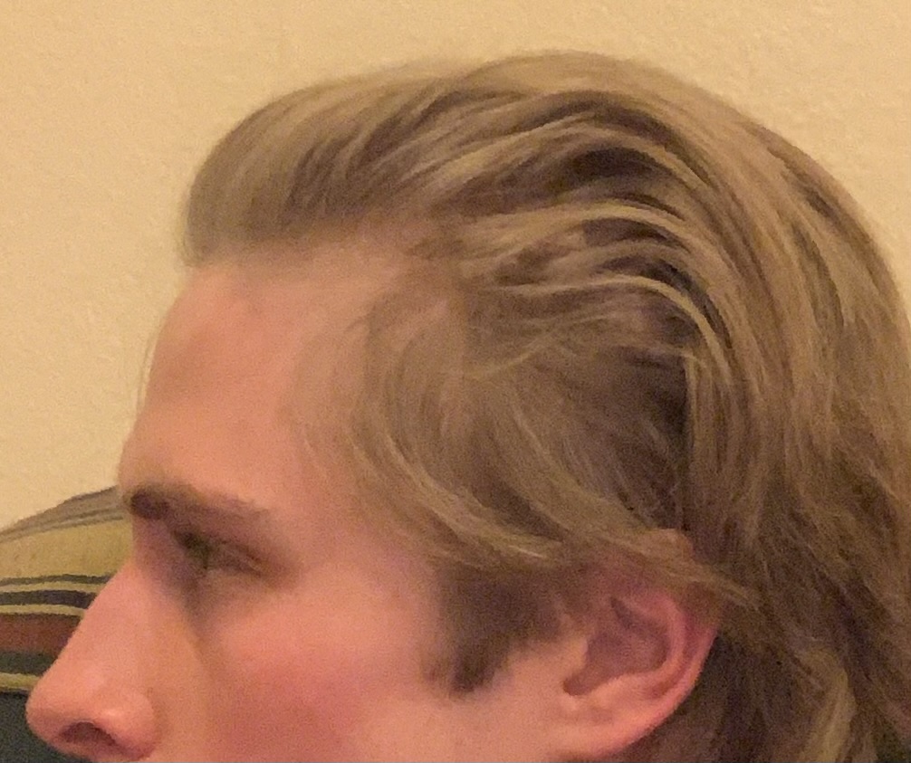 IMG 1644