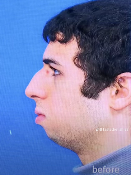 4b25242a20a3093c26cbbae2089b6b6d 4b25242a20a3093c26cbbae2089b6b6d