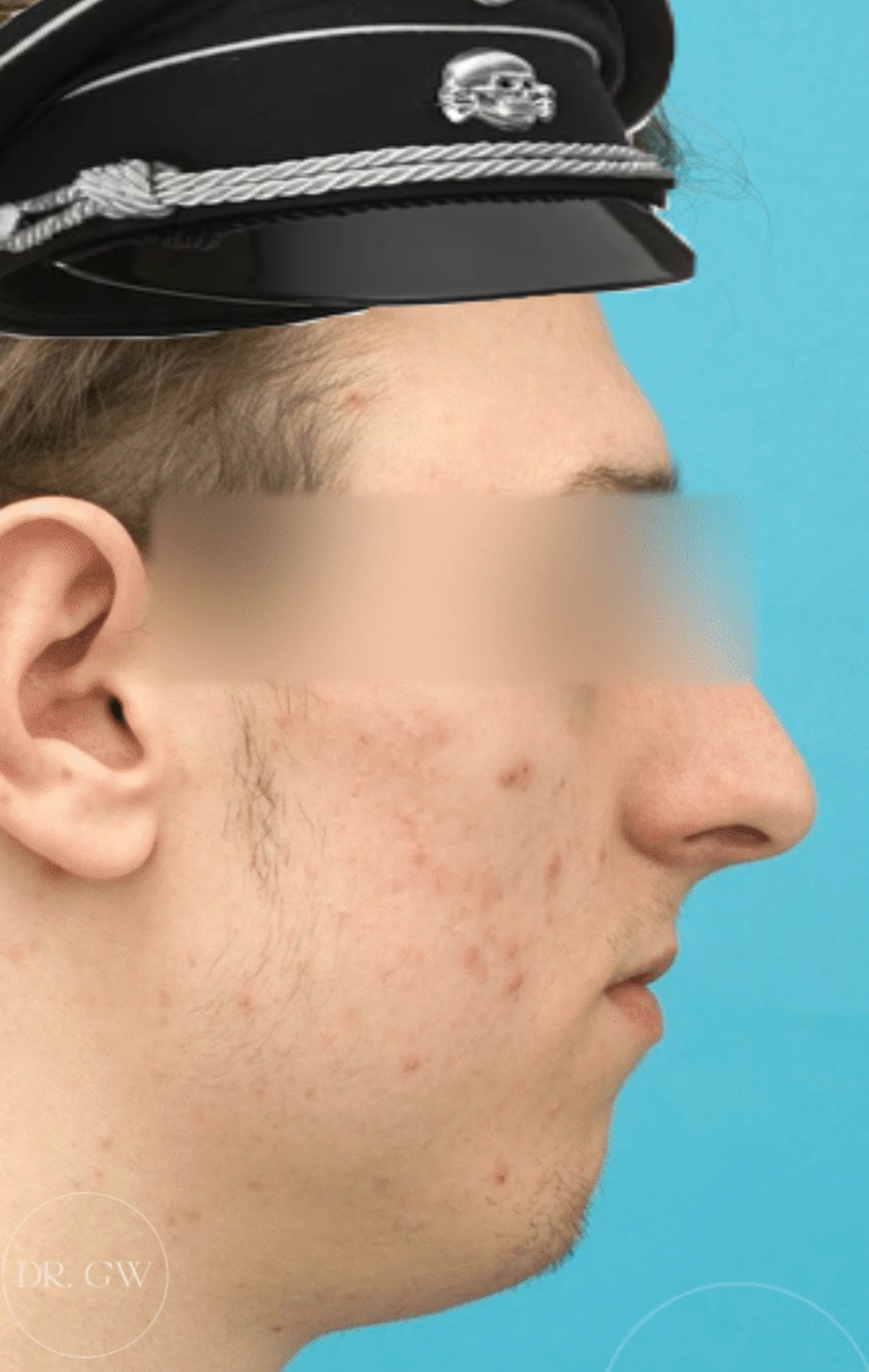 0E66965B 74DA 4F51 9099 EA5BD224E7DC