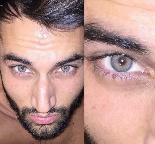 Eyecos cambio color ojos resultados