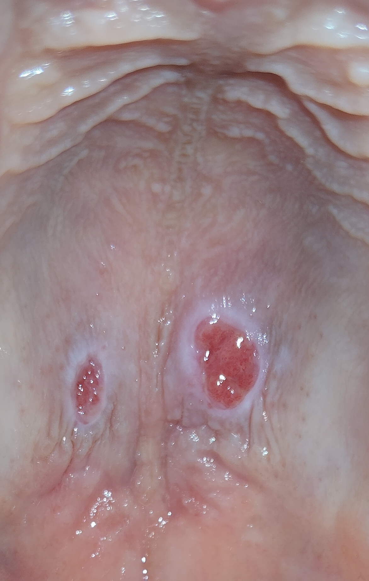 1000076635 1000076635