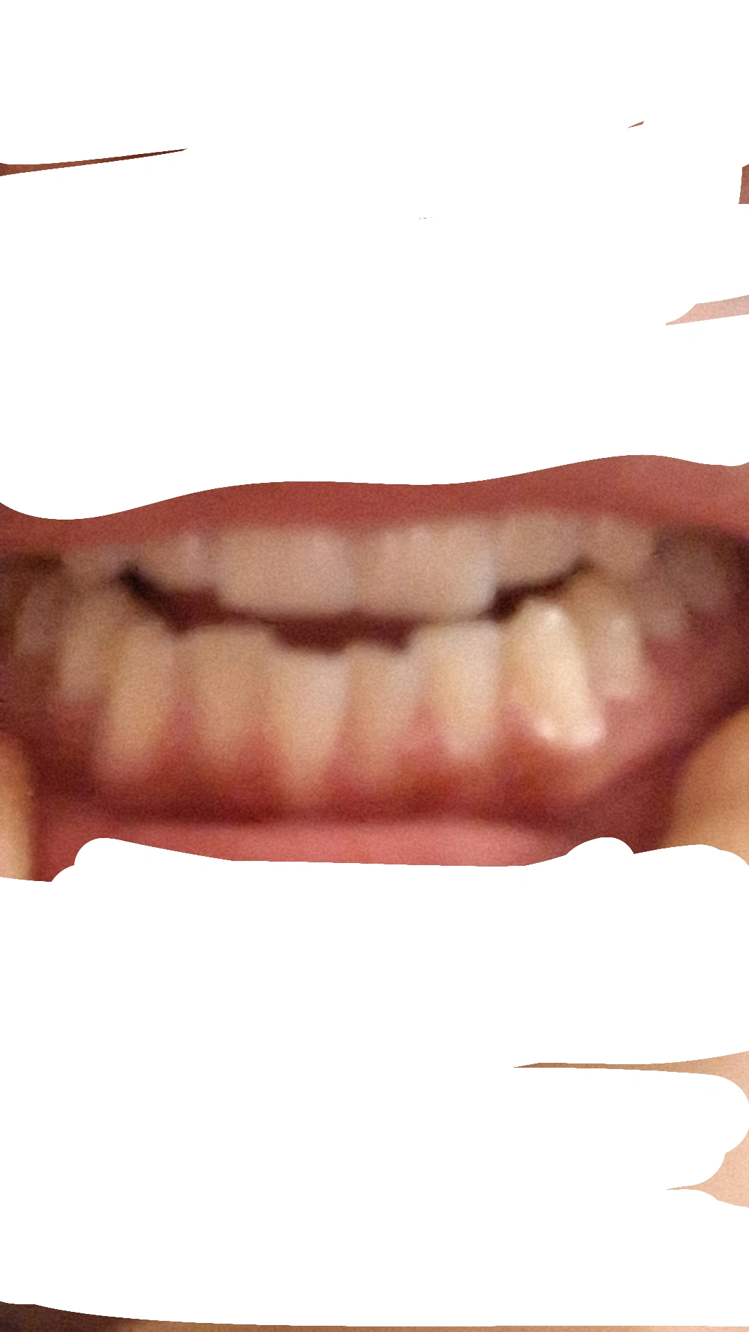 1000110071 1000110071