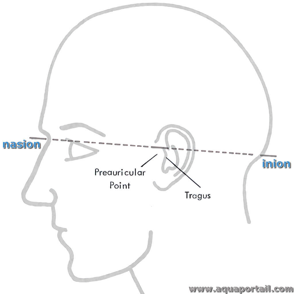 Nasion inion