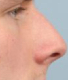 IMG 7754