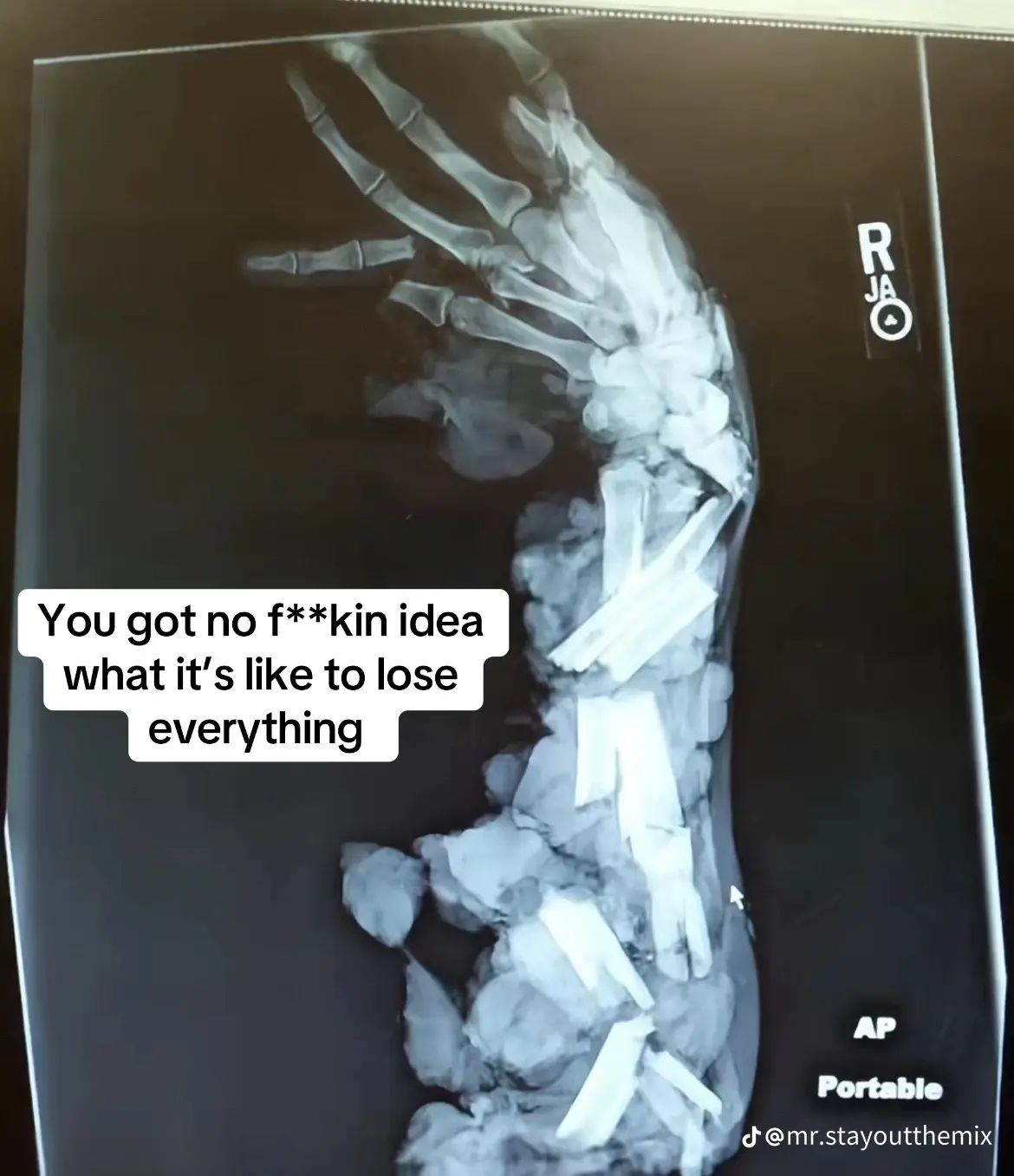 Temp image 52EB036D DCD1 4245 AE0E 35F951A798A0