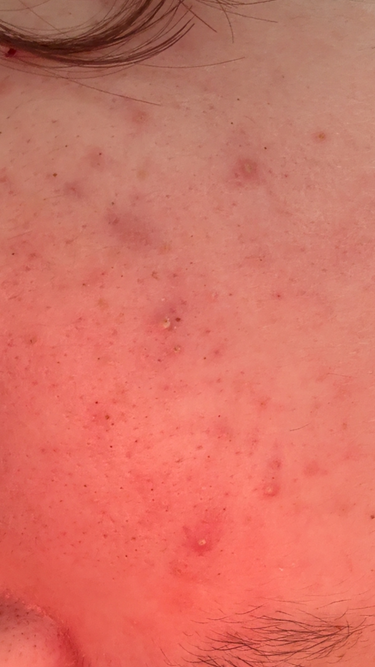 IMG 0956