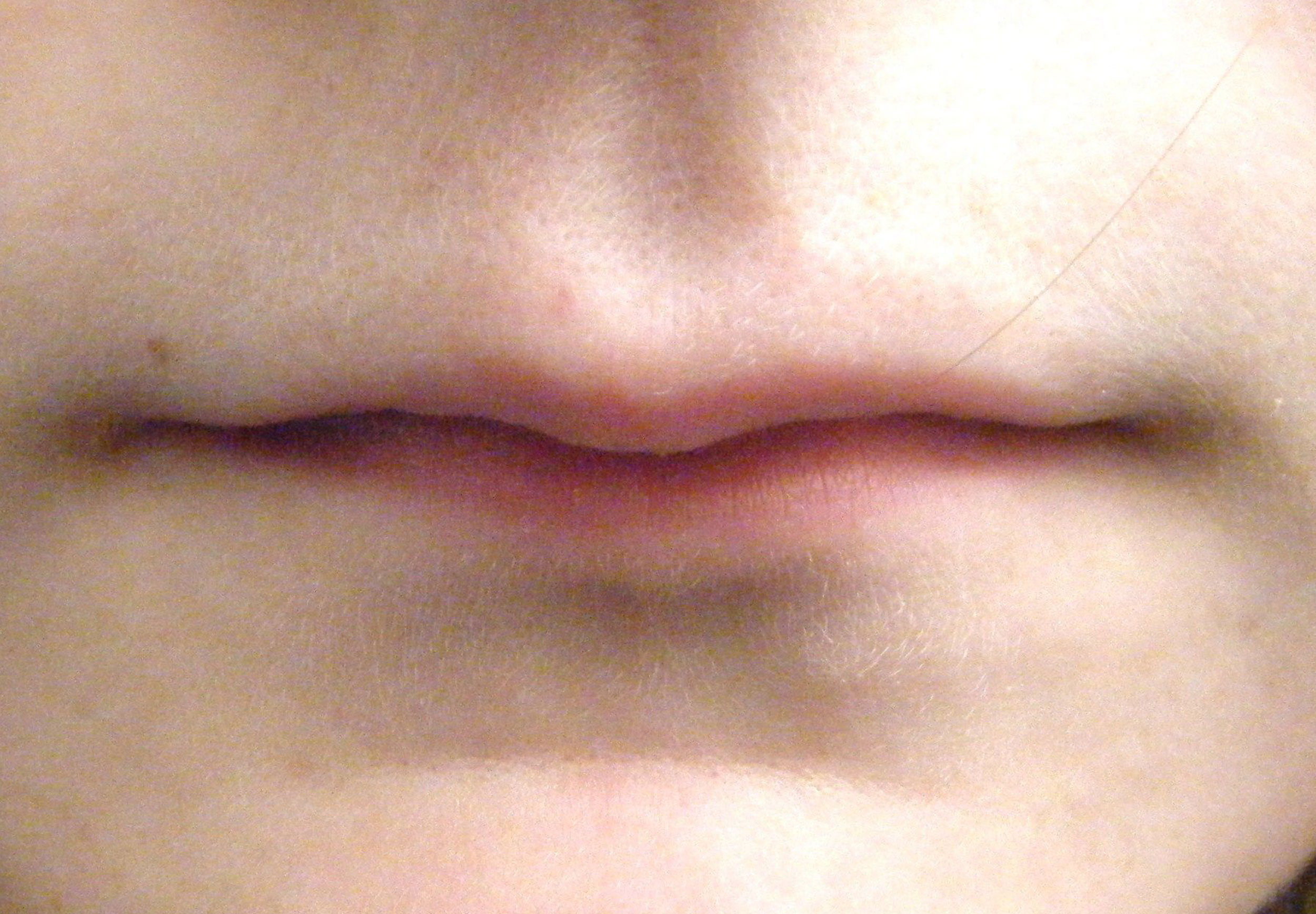 62b566b0185104b360162964 alisha louise aesthetics thin lips