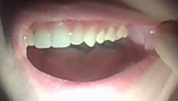 Teeth Teeth