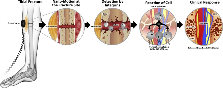 diagram of how LIPUS works diagram of how LIPUS works