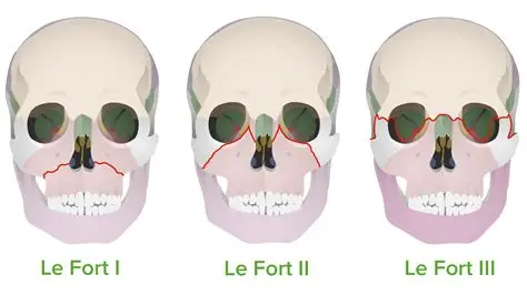 Leofrt Leofrt