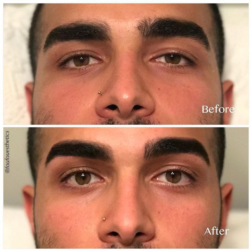 1000090493 1000090493