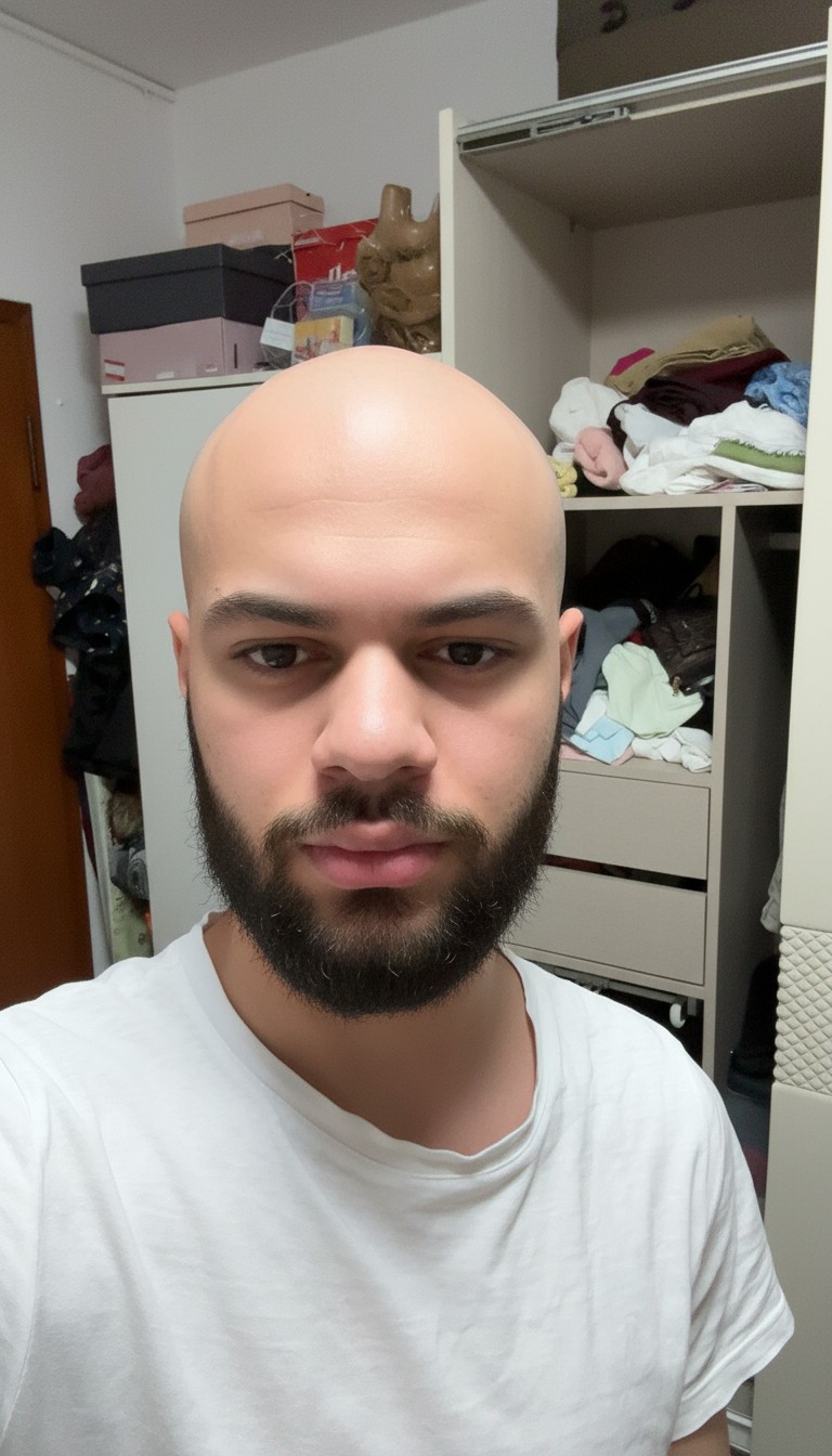 Gemini 25 flash image preview nano banana a Make this guy bald 