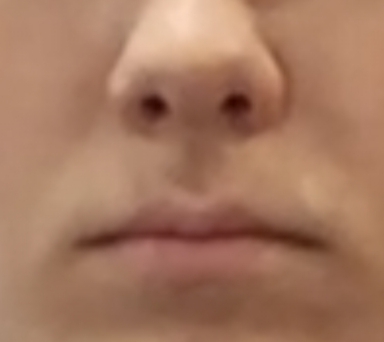 1000027798