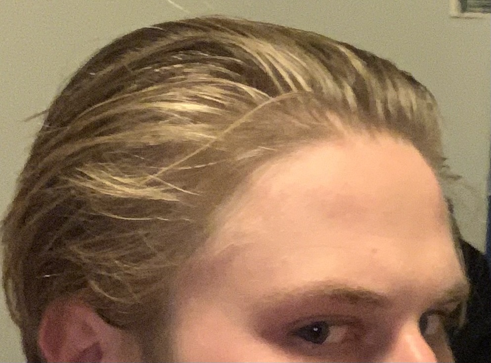 IMG 2174