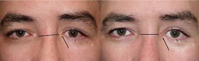 2images 2