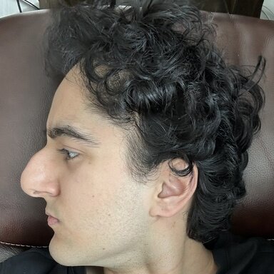 1000022670