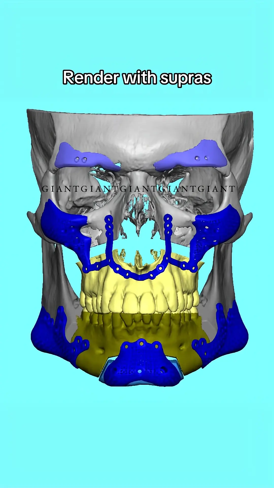 1000021991 1000021991