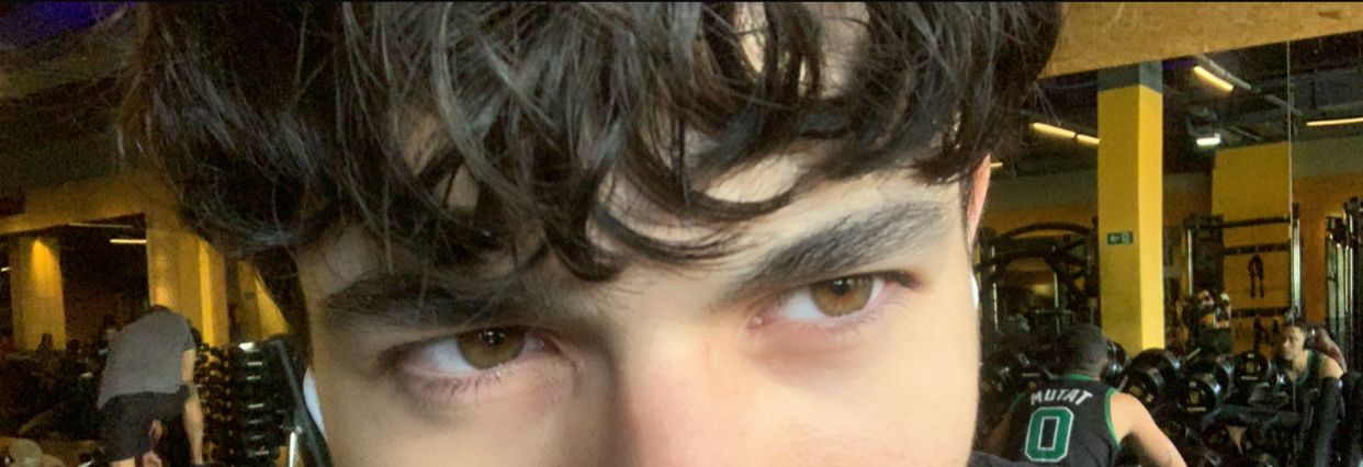 Eye area