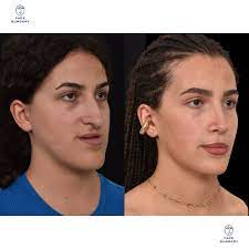 1761414170632 1761414170632