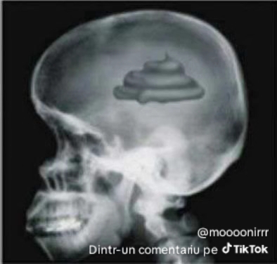 1000211370 1000211370