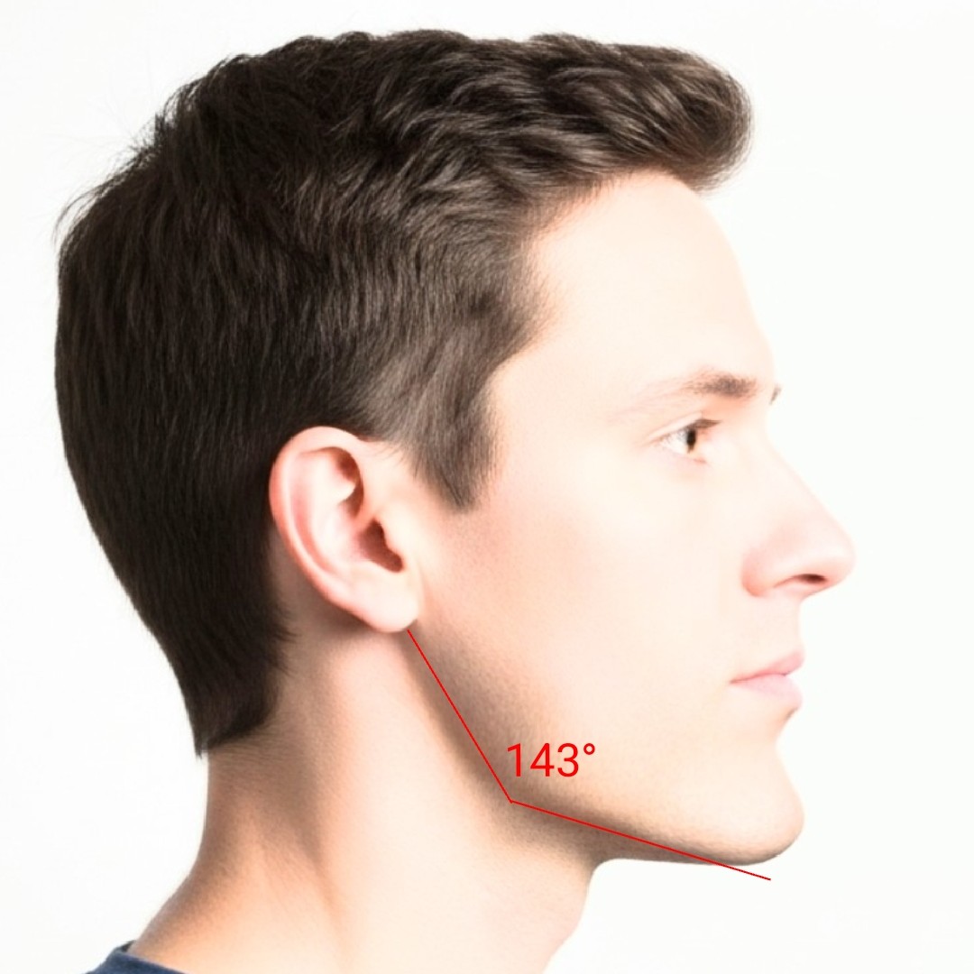 1000018625 1000018625