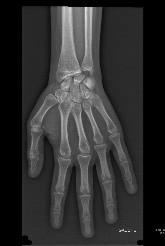 Radiomainaura 1 Radiomainaura 1