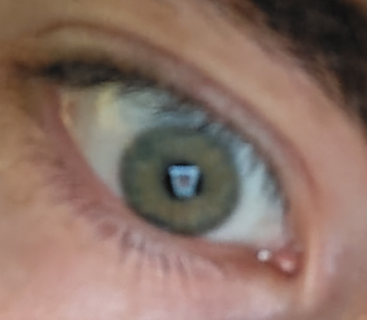 1000001642 1000001642