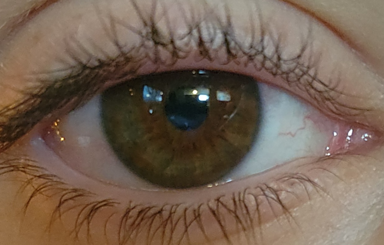 1000067790 1000067790