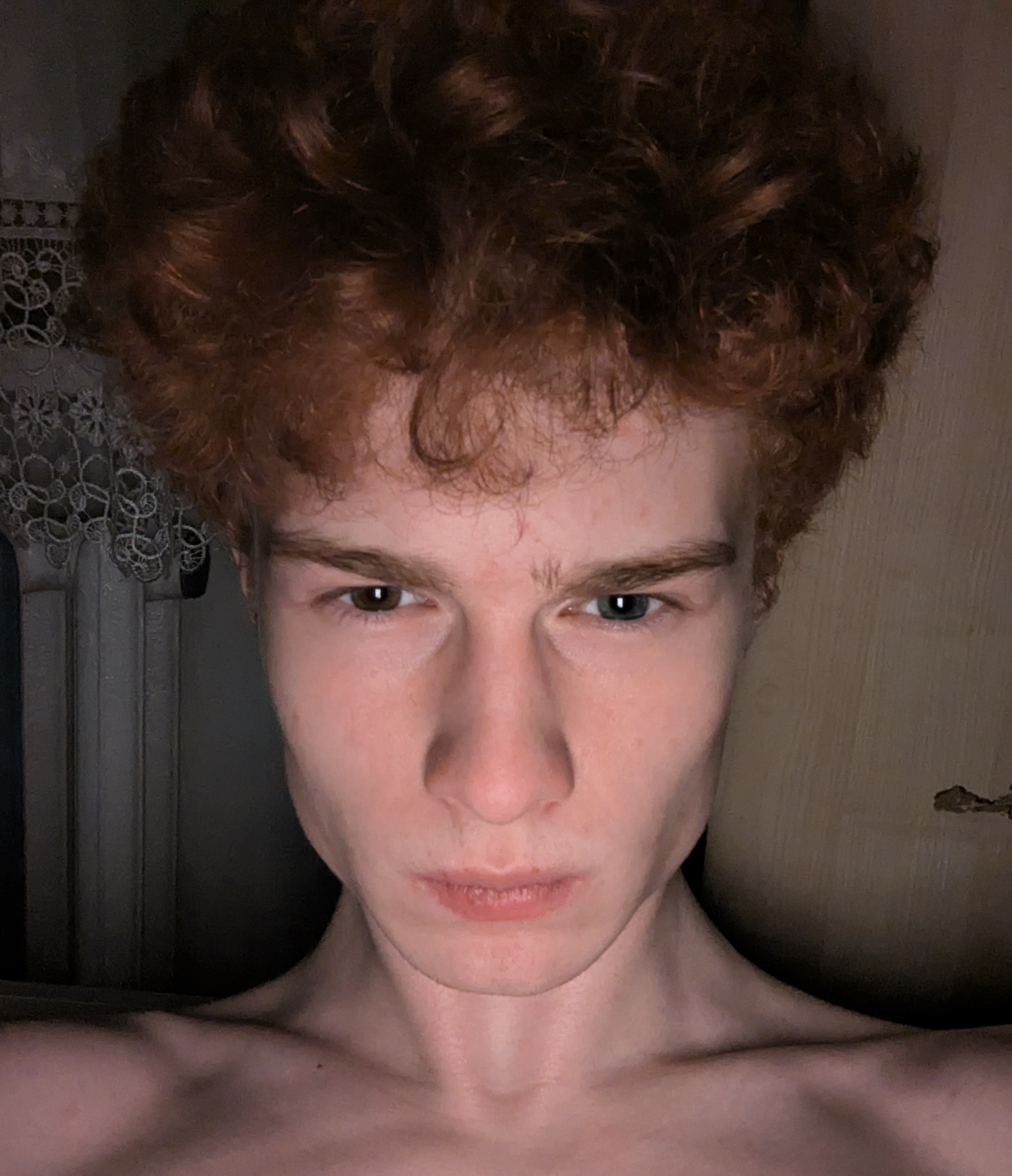 1000008855 1000008855