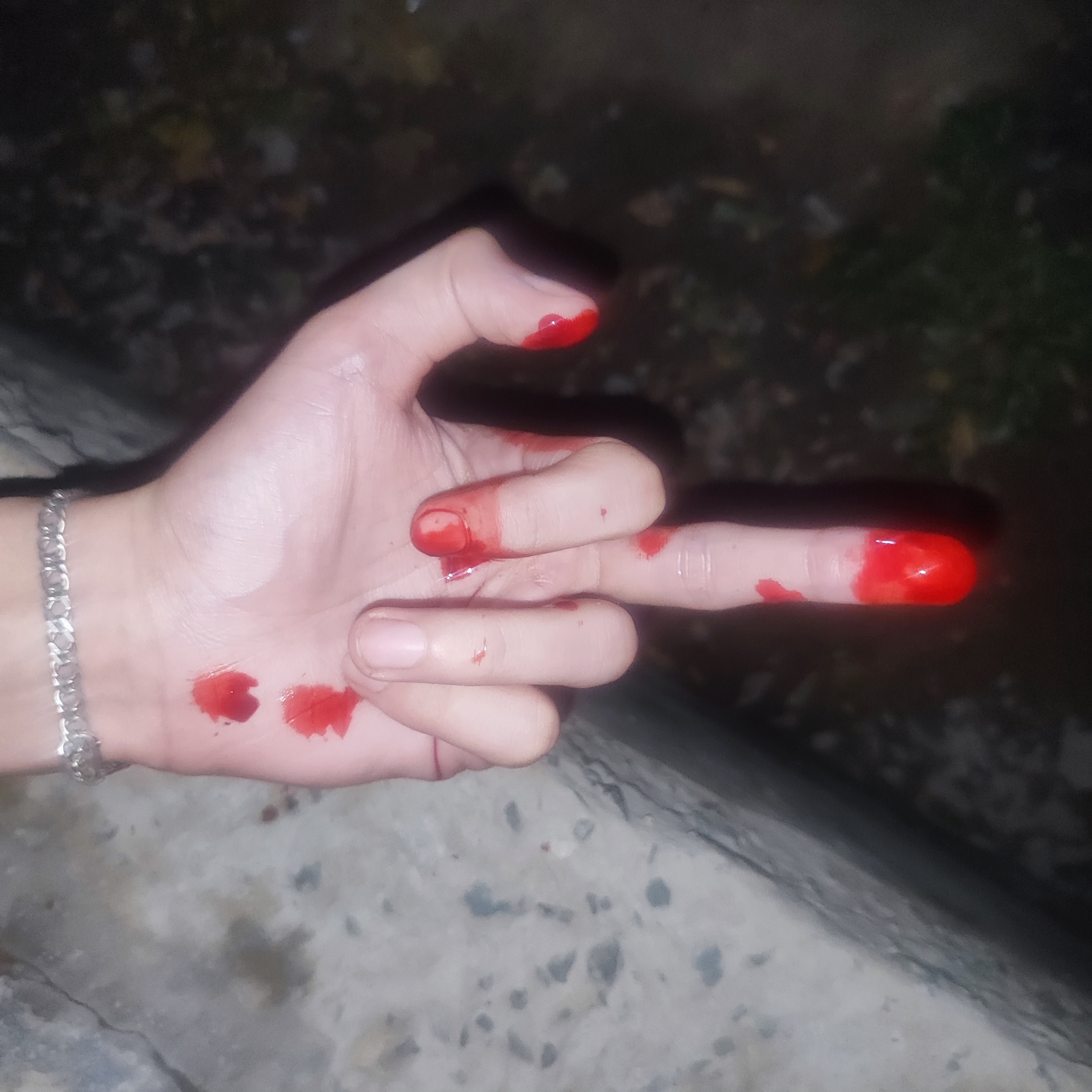 1000020628