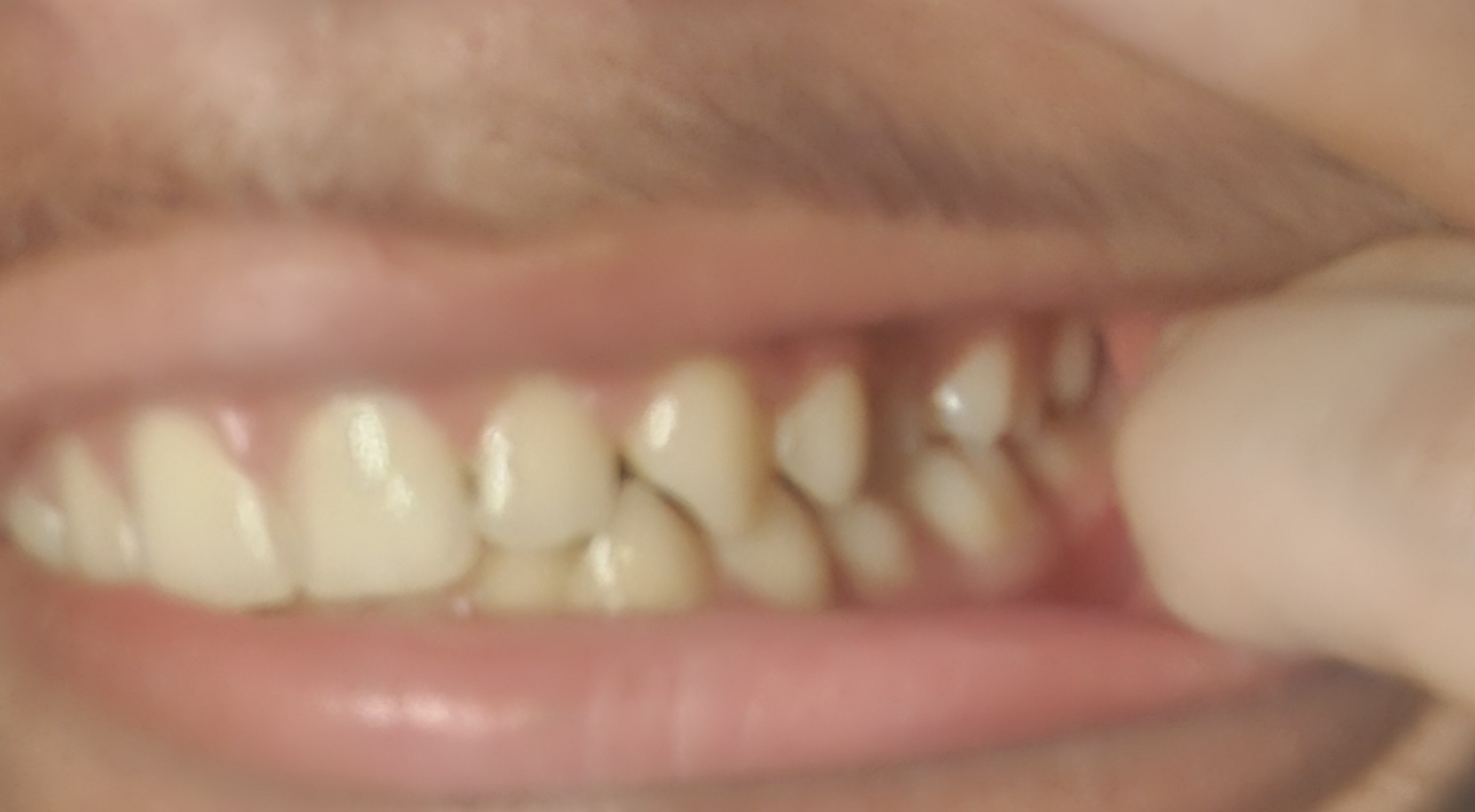 1000020279 1000020279