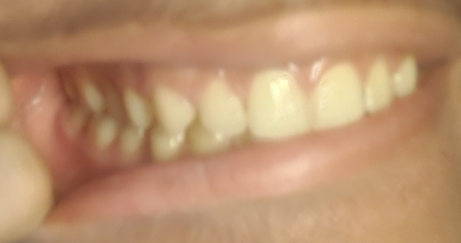 1000020281 1000020281