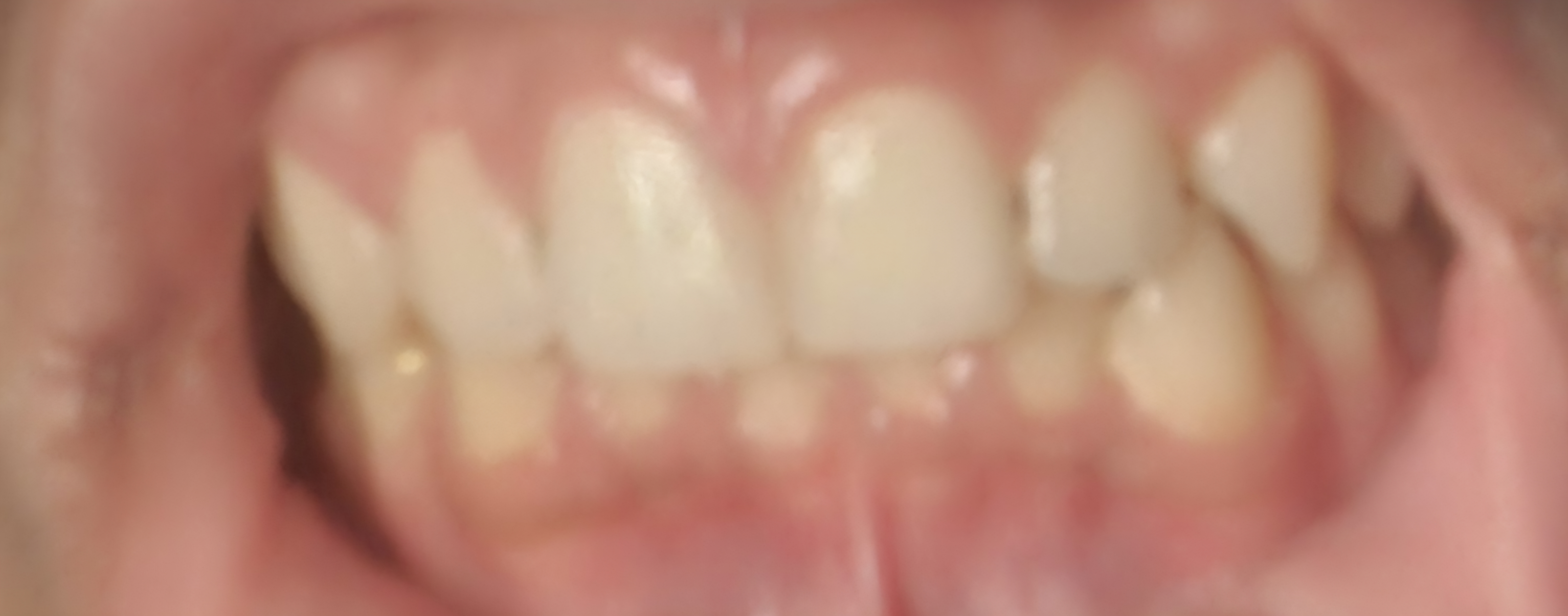 1000020278 1000020278