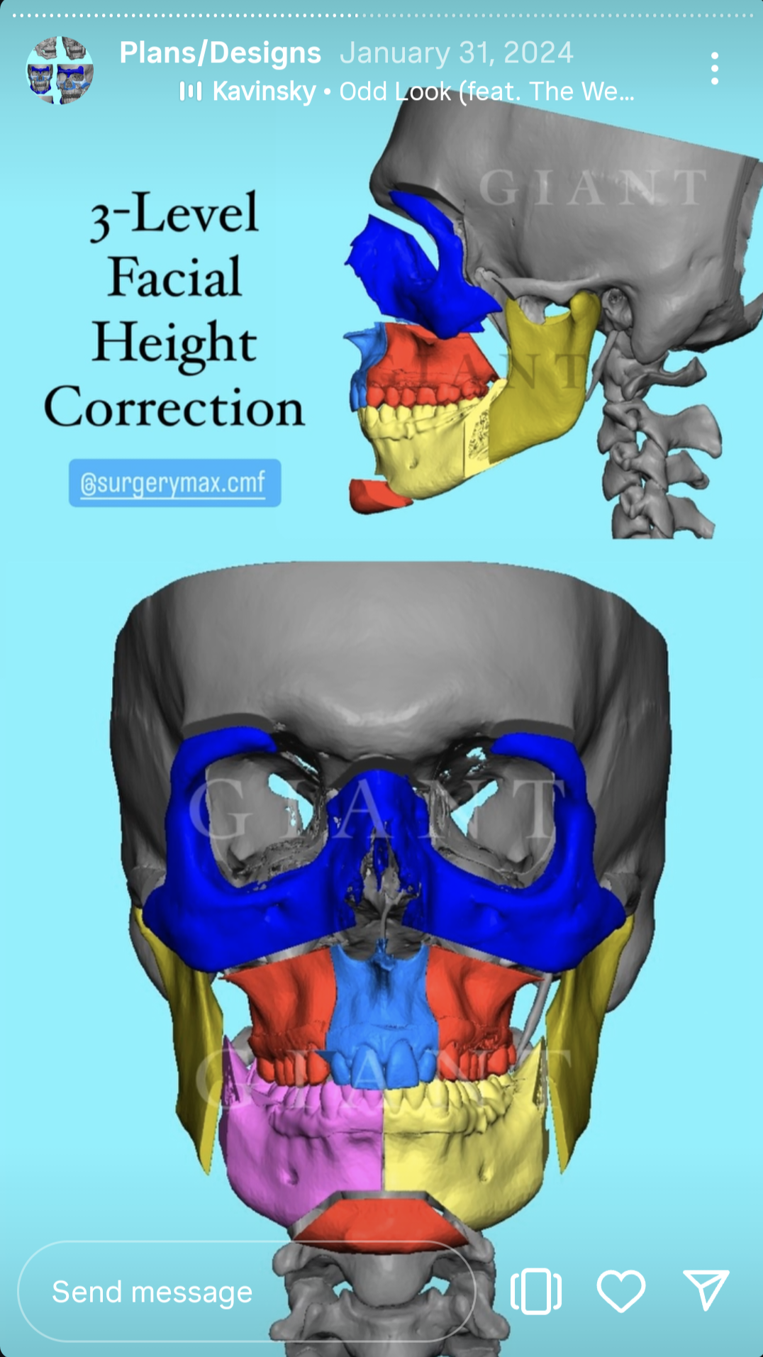 Screenshot 20250621 030908 Instagram Screenshot 20250621 030908 Instagram