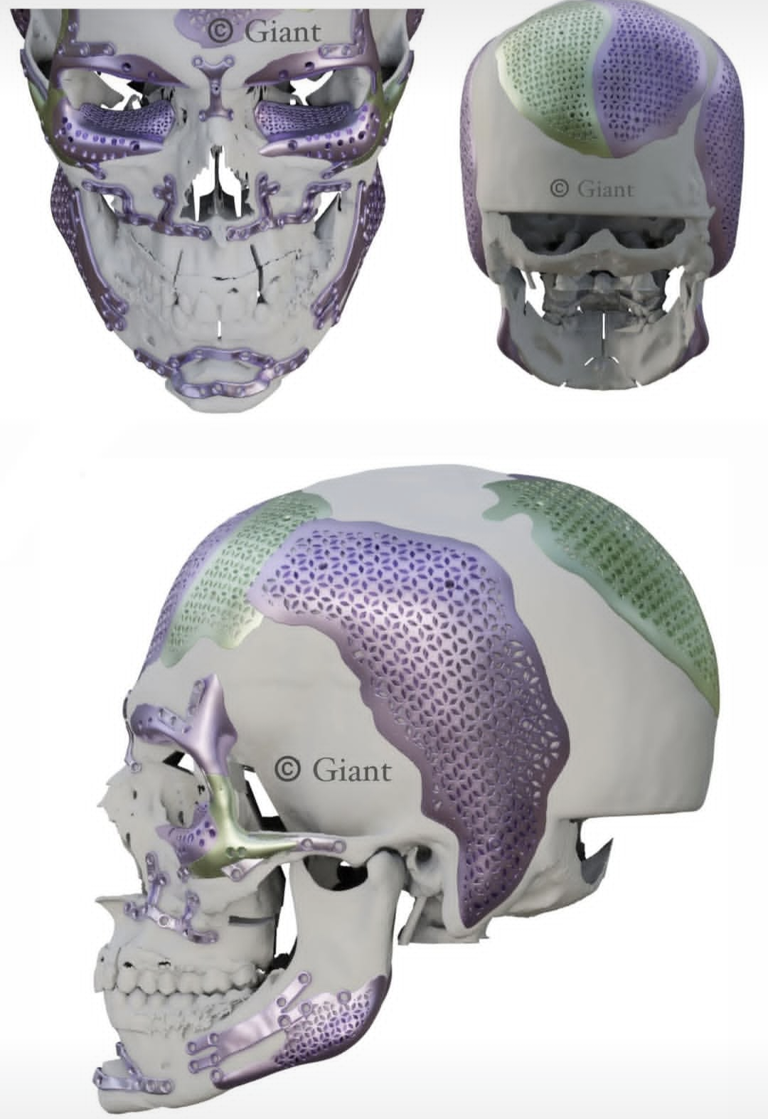 Screenshot 20250621 031044 Instagram Screenshot 20250621 031044 Instagram