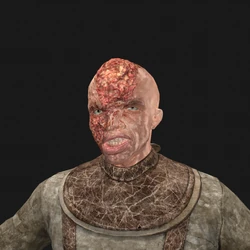 Patient4 face Patient4 face