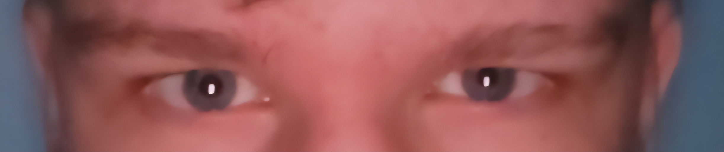 1000033489 1000033489