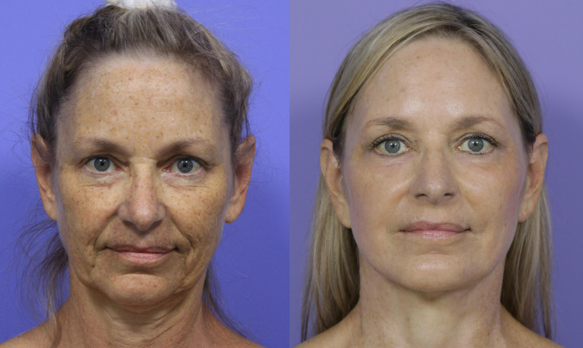 1761849594296 1761849594296