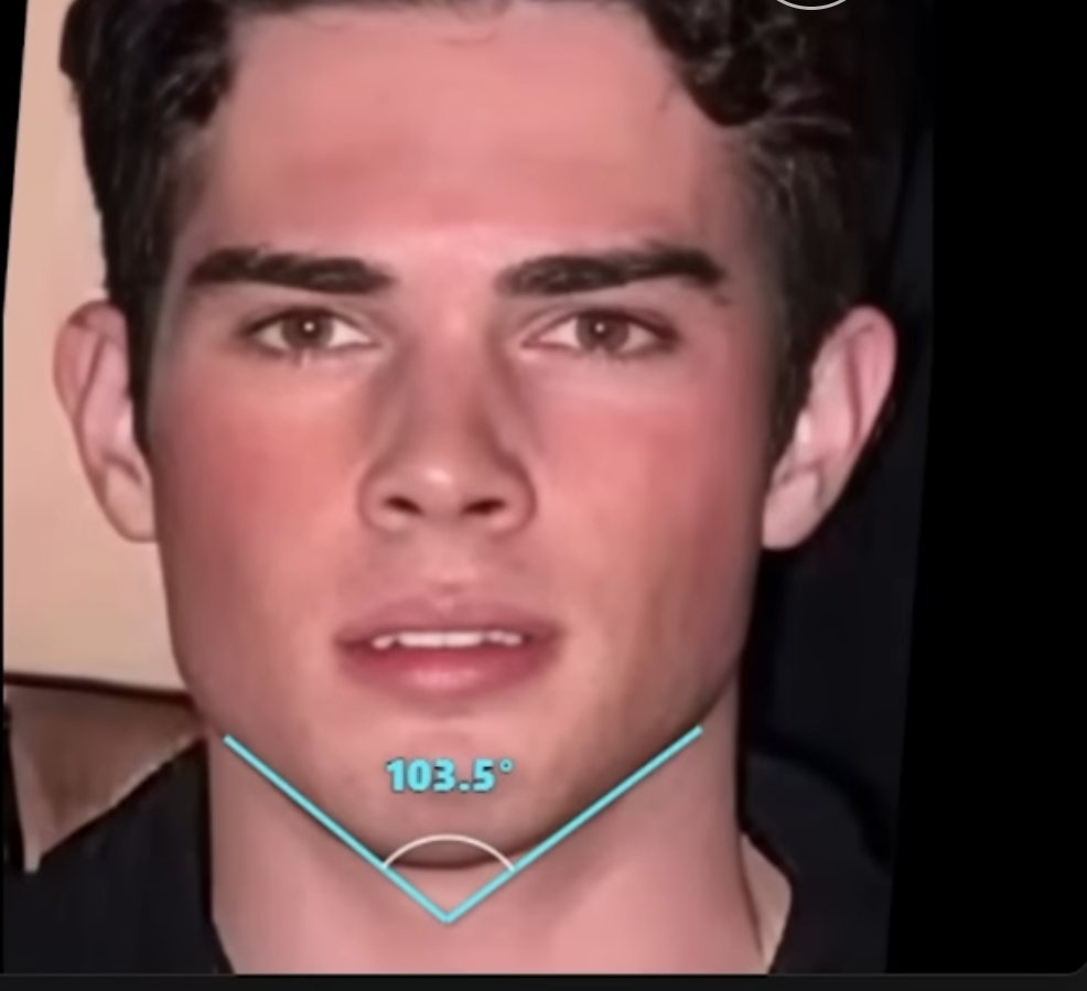 1000027620 1000027620