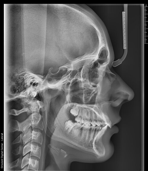 xray.jpg
