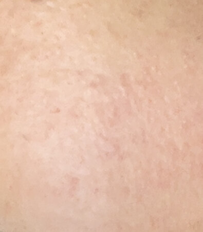 IMG 0665