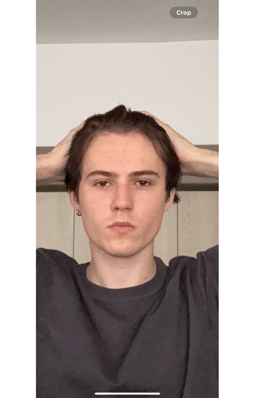 before.png