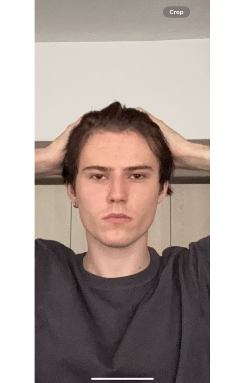 after.png