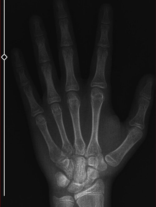 Xray.jpg