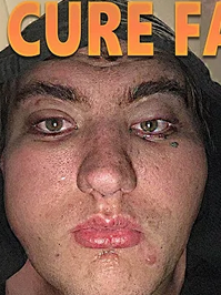 Chad Chad