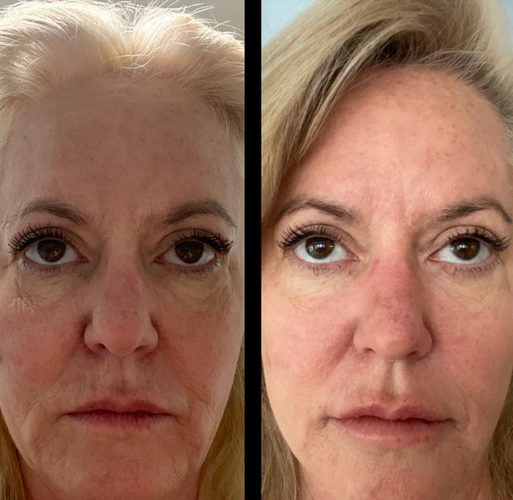 4974257 1747759409520