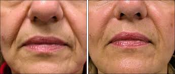 4974223 1747757503356