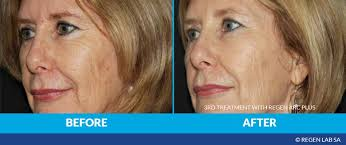 4974256 1747759395914